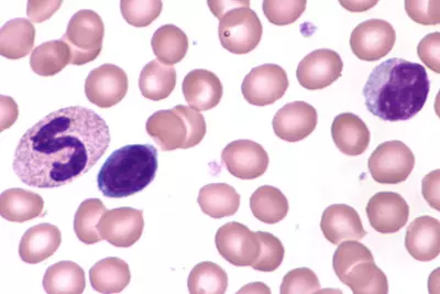 Neutrophil Band Cell 1 Lymphocytes