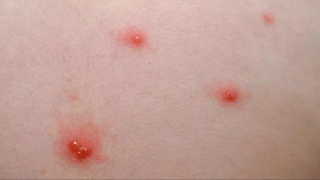 Image3